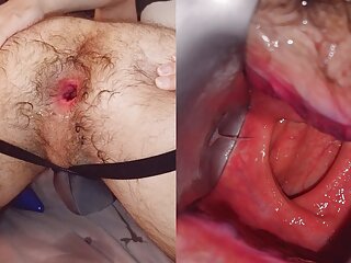 Hairy And Gaped Wide - Inside View Though Speculum And Noisy Hole Gape free video